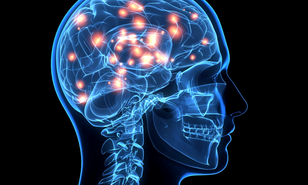brain-gluten-orig-1000x600-53ae039bc789ffa8e3f7e7c5700474b4.png