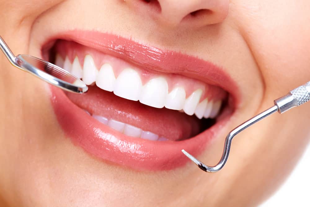 Hal-Hal Yang Perlu Diperhatikan Dalam Menjaga Kesehatan Gigi
